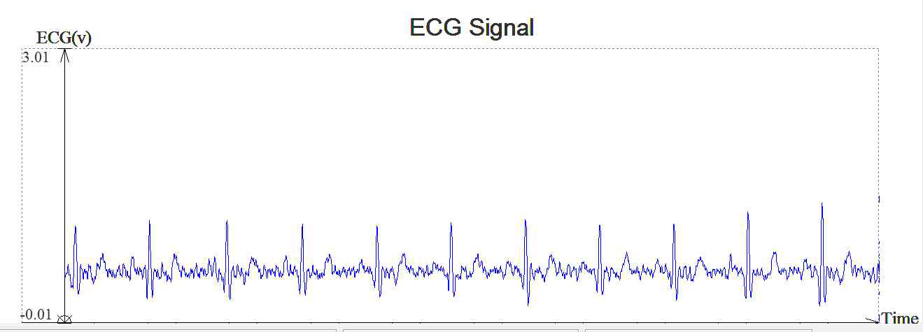 2point ECG 측정 장비로 검출한 ECG 신호