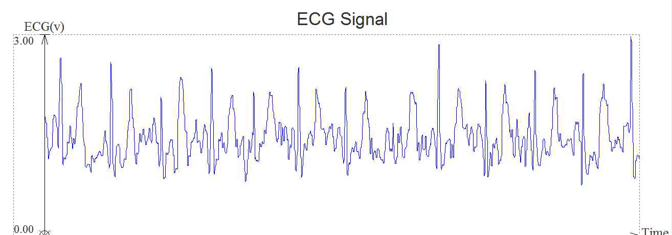 2point ecg 측정 장비와 실제 주행 차량에서 검출한 ECG 신호