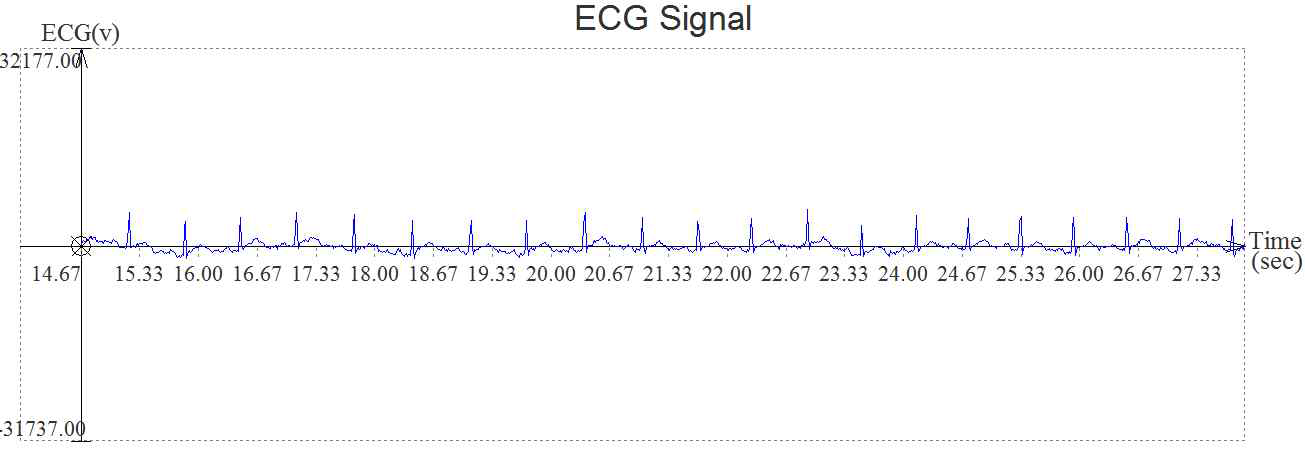 2point ECG 측정 장비와 BM-5(3point)에서 검출한 ECG 신호