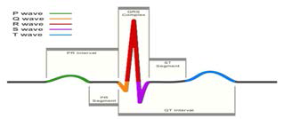 ECG (Electrocardiogram)