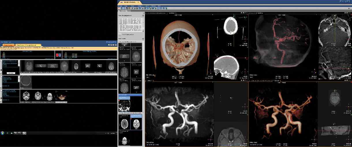 Philips Healthcare의 PACS Viewer