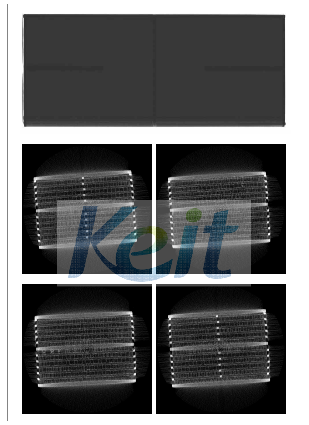 CT 단층검사 결과