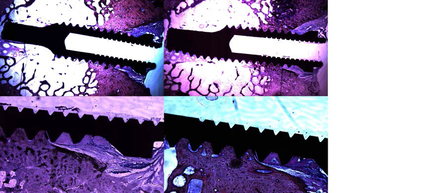 하나의 치과용 임플란트 당 2개의 비탈석회화 조직슬라이드를 제작하여 두 조직 슬라이드 간의 골질 분석간의 일치도를 분석하였다. 같은 임플란트에서 얻은 절편 사이에서도 임플란트-골 임계구간의 골형성의 차이가 분명하였다.