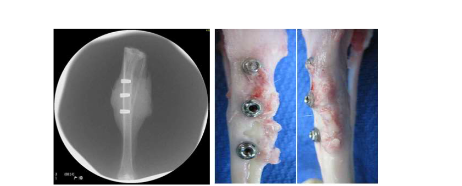 TCP bead 이식군 4주 후 단순 방사선 사진(좌) 및 육안 모습(우)