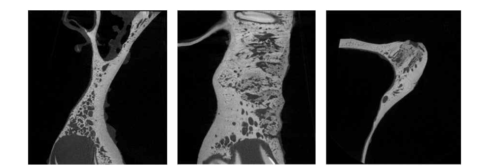 TCP bead 8주 micro-CT 사진. 관상면(좌), 시상면(중), 액와면(우)