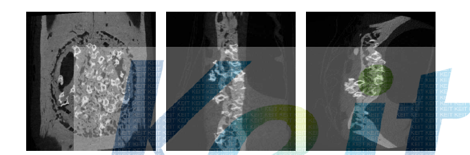 두개골 골결손 모델 micro-CT 이미지, 골형성량 분석