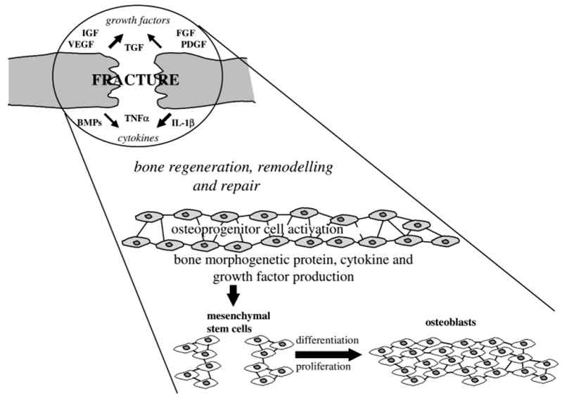 골절 및 골재생시 관여하는 성장인자 모식도
