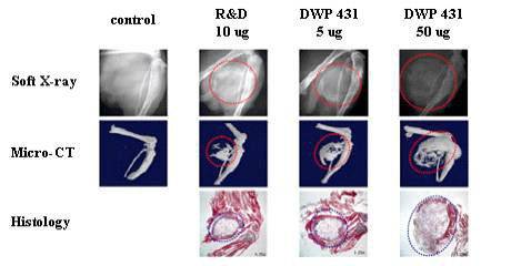 골형성 모델에서 soft X-ray, micro CT 및 masson trichrome stain 조직 분석을 통한 대웅 BMP-2의 골 형성 유도능 평가