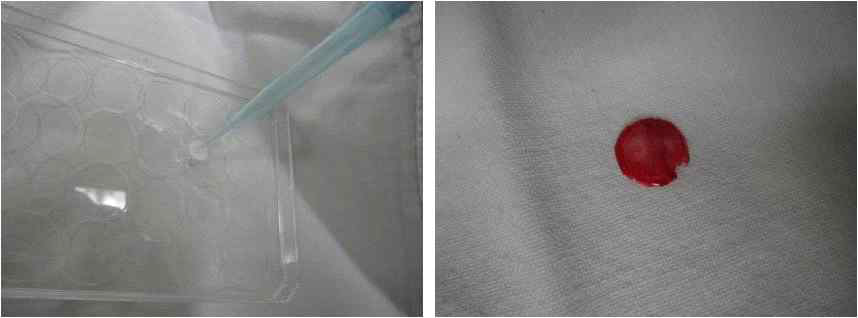 collagen carrier에 정해진 생체활성물질을 담지하는 모습(좌), SD-rat에서 8mm trephin으로 제거한 골조직(우)