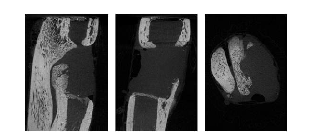 제 1군 collagen 8주 micro-CT 사진