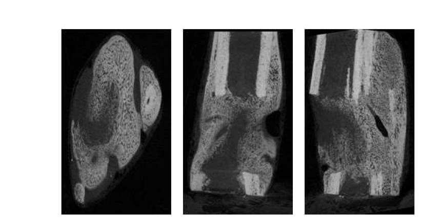 제 2군 collagen + BMP-2 4주 micro-CT 사진