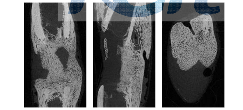 제 3군 collagen + BMP-2 + EGF 8주 micro-CT 사진