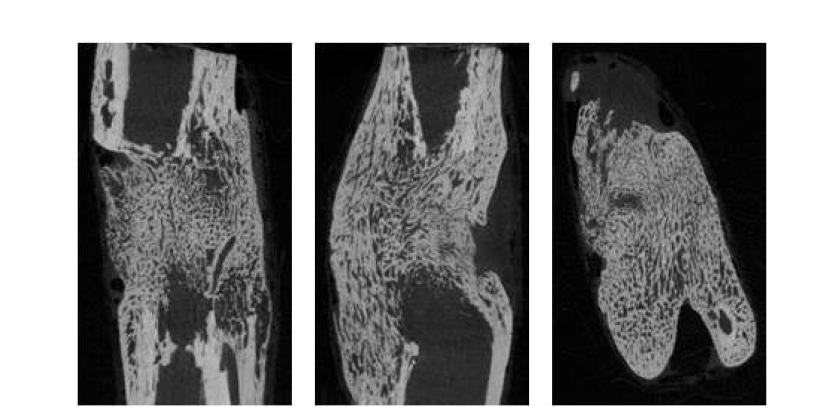 제 4군 collagen + BMP-2 + FGF 8주 micro-CT 사진