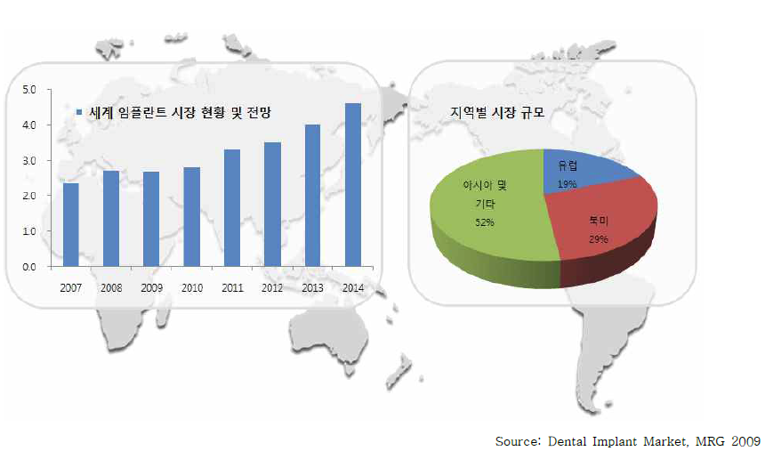 글로벌 임플란트 시장 성장 추이