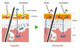 정상피부와 건조피부
