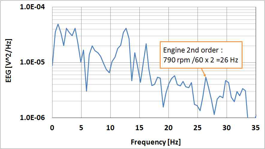 Engine vibration noise in EEG signal
