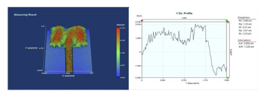 Profile of conductive pattern