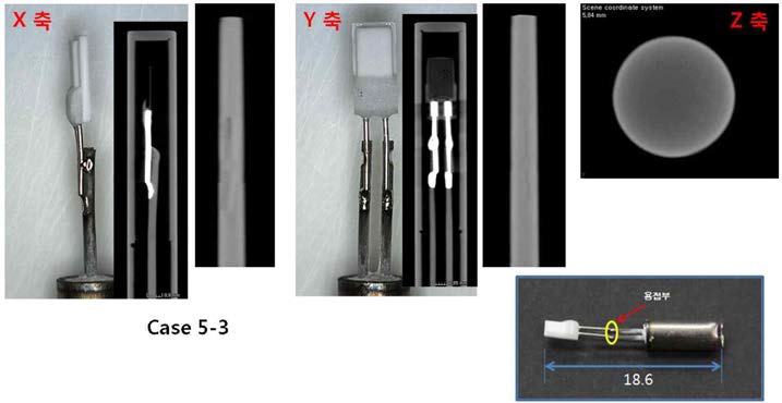 case 5-3 CT 촬영 이미지