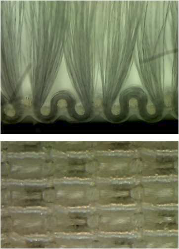 신규 조직 현미경 사진
