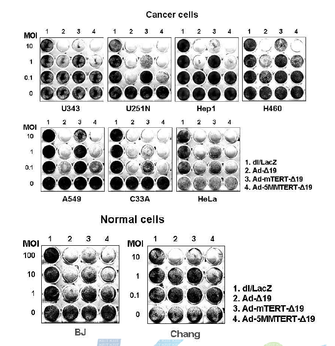 개선된 종양 선택적 활성 프로모터를 가진 아데노바이러스의 암세포 특이적 살상능 검증