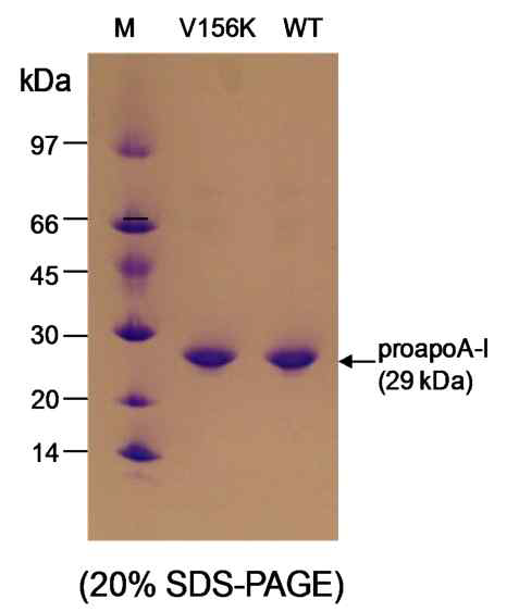 Purified wildtype and V156K apoA-I(20% SDS-PAGE) is indicated by the arrow. laneM,low-range molecular weight markers