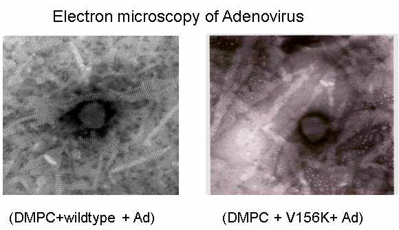 Electron microscopy of the negatively-stained PL-containing adenovirus