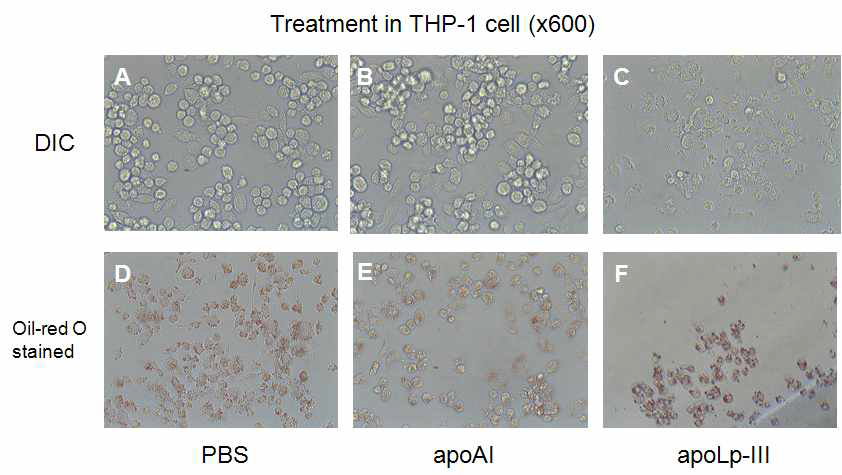 THP-1 cells 의 Oil red O staining 을 이용한 Oxidized LDL uptake assay