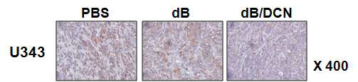 Decorin을 발현하는 종양 선택적 살상 아데노바이러스에 의한 종양 조직내에서의 collagen type I 발현 양상 비교(면역조직 염색법)
