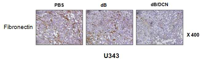 Decorin을 발현하는 종양 선택적 살상 아데노바이러스에 의한 종양 조직내에서의 fibronectin 발현 양상 비교(면역조직 염색법)