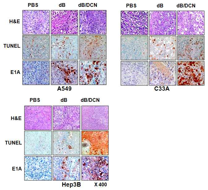 Decorin을 발현하는 종양 선택적 살상 아데노바이러스에 의한 종양 조직 내의 변화(H&E) 및 세포고사 현상(TUNEL assay)과 아데노바이러스 입자(면역 조직 염색법) 관찰