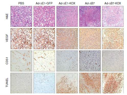 VEGF-A의 발현을 억제할 수 있는 zinc finger protein을 발현하는 종양 특이적 살상 아데노바이러스를 투여한 종양의 조직학적 분석