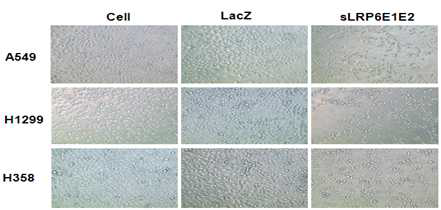 LRP6 E1-E2처리에 의한 세포 증식억제능을 광학현미경으로 세포 관찰