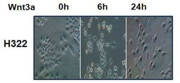 폐암세포주에 Wnt3a 처리에 의한 형태학적 변화 관찰