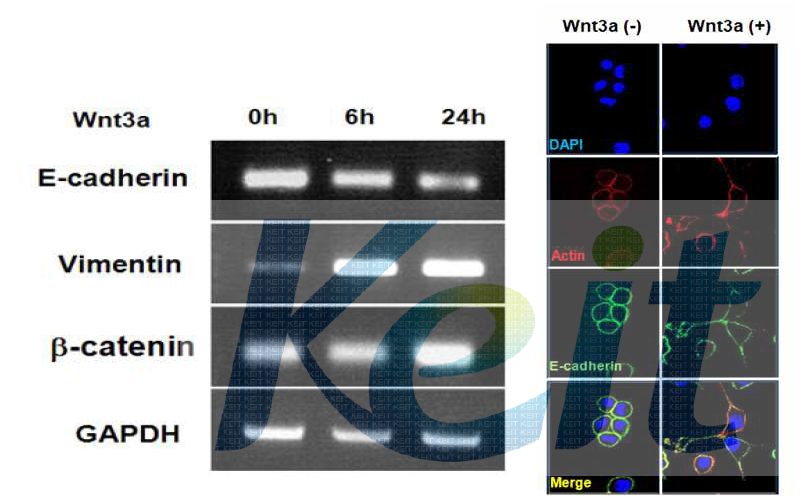 Wnt3a의 처리에 의하여 EMT marker들의 변화를 관찰