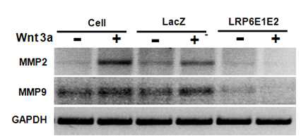 LRP6 E1-E2의 처리에 의한 MM2와 MMP-9의 발현변화의 관찰