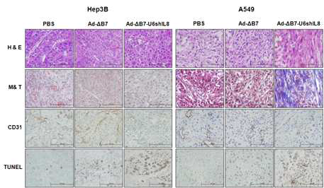 shIL8을 발현하는 종양 선택적 살상 아데노바이러스를 투여한 경우의 종양 내 조직 변화 관찰