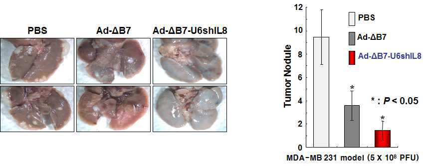 MDA-MB-231 유방암 폐전이 모델에서 전이암 치료제로서의 효능 검증