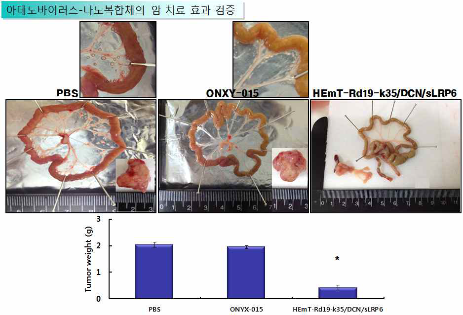 MIApaca-2-fluc 전이성 췌장암 동물 모델에서 종양 특이적 살상 Ad 투여후 장간막에서의 복강내 전이 확인 및 종양 무게 감소 확인