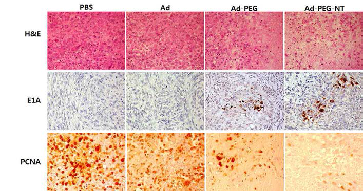 췌장암 동소이식모델에서 아데노바이러스-나노복합체 투여에 의한 종양조직 살상능 및 복제능 및 종양성장 억제능 비교