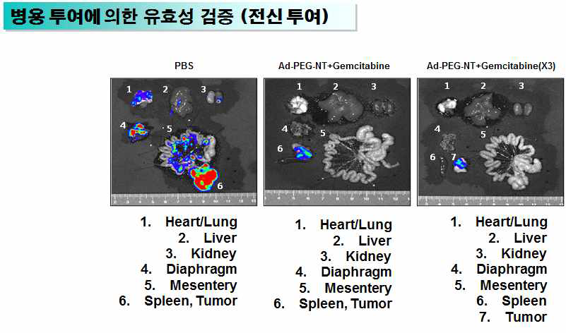 Panc-1/fluc 동소이식 췌장암 모델에서 아데노바이러스-나노복합체와 Gemcitabine의 병용투여 및 Gemcitabine 반복투여에 따른 항종양 효과의 유효성 검증