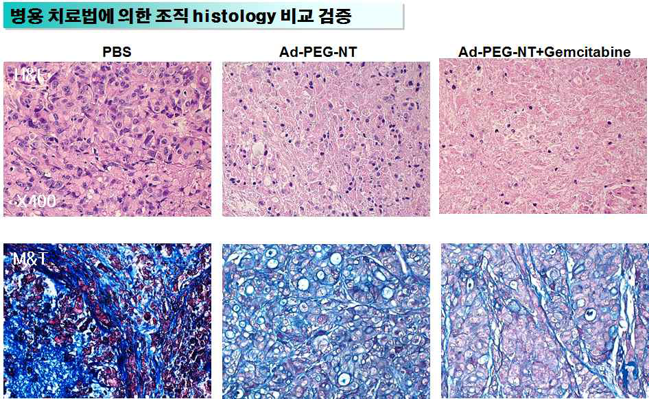 췌장암 동소이식모델에서 아데노바이러스-나노복합체와 Gemcitabine 병용투여에 의한 조직 histology 비교결과