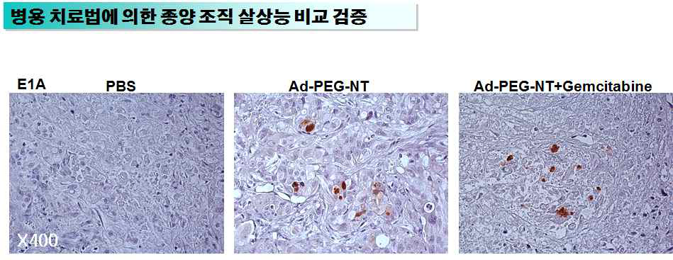 췌장암 동소이식모델에서 아데노바이러스-나노복합체와 Gemcitabine 병용투여에 의한 종양조직 살상능 비교