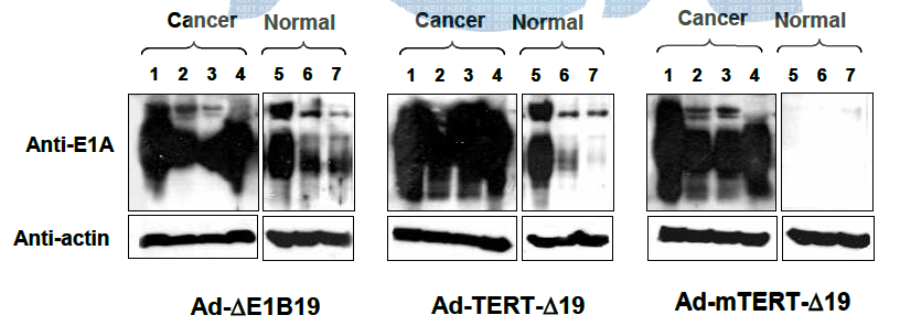 아데노바이러스의 암세포 특이적 복제능 검증