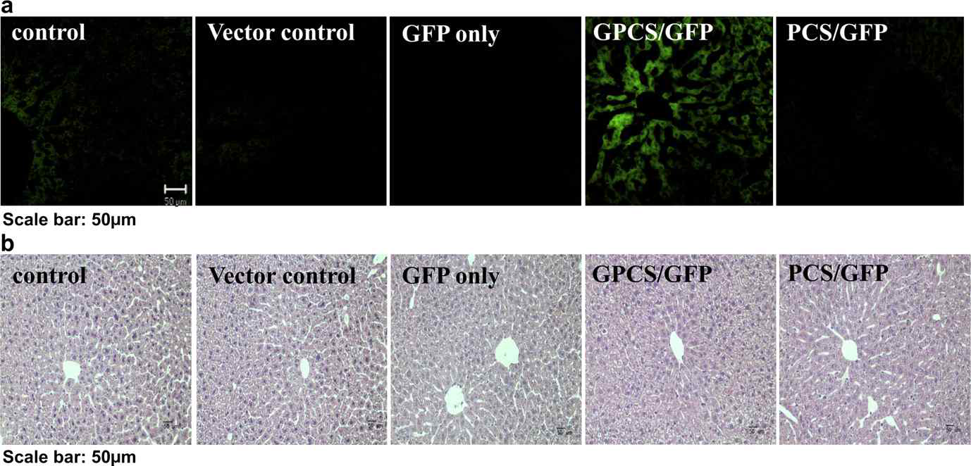 실제 mouse를 이용한 간에서의 GPCS/GFP의 발현 (a) CLSM을 통한 GFP 형광 확인 (b) H&E 염색을 통한 간에 서의 독성여부 확인