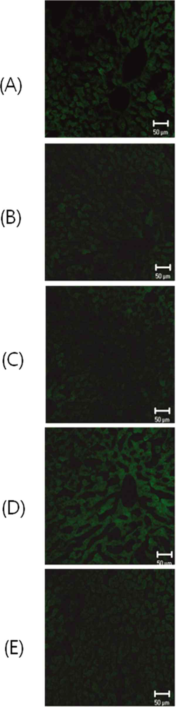 간으로의 GCS/GFP 전달효율 (a) control (b) vector control (c) GFP only (d) GCS/GFP (e) Chi-g-SPE