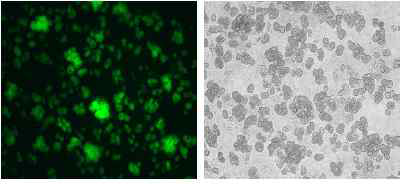 분리된 쥐 간세포에 electroporation으로 GFP 발 현벡터를 도입하고 collagen coating된 plate에서 배양 후 형광현미경으로 이미지를 분석 한 결과.