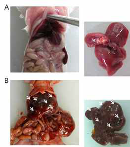 간암세포 이식 미우스의 해부학적 분석. (A) 정상마우스의 간 조직. (B) 간암 세포주 Huh7이식 8주후 간 조직.