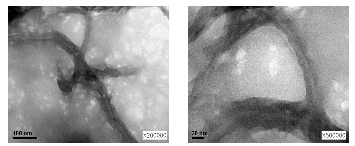 CNT/PEDOT composite의 TEM image.