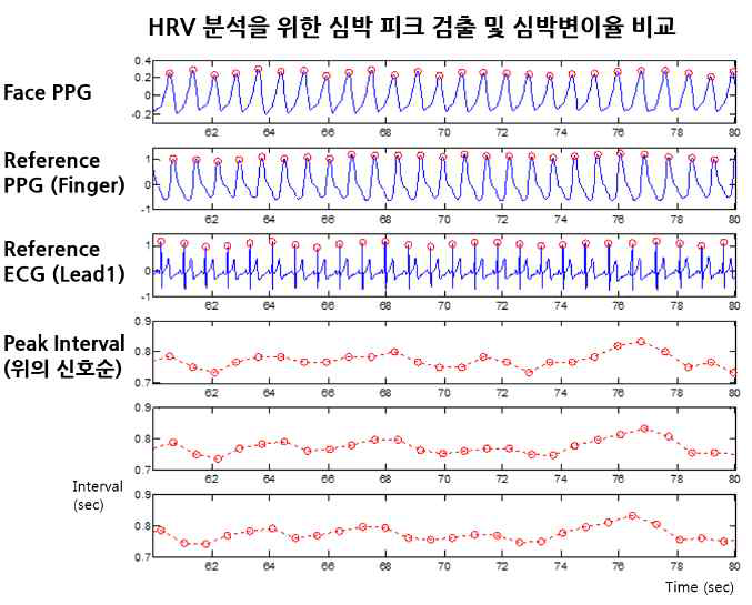 HRV 분석을 위한 심박 피크 검출 및 심박변이율 비교