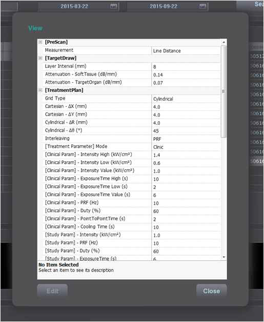 ALPIUS 900의 User Setting